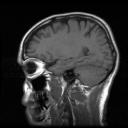 brain